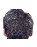 Wt-Methode Placen Formula Hp - Лосьон против выпадения волос 12 ампул по 10 мл